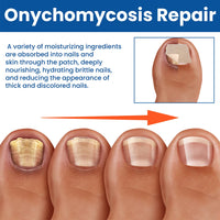 Kerava Nail Renewal Patches